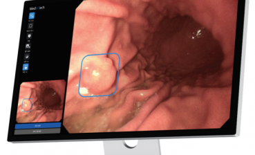 Phần mềm AI hỗ trợ chẩn đoán và phân loại tổn thương cho dạ dày và đại tràng